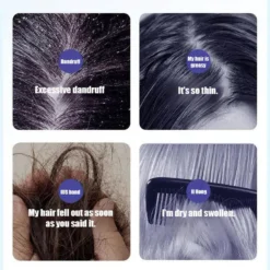 Alternative view of Deep Moisture Refreshing Dandruff Control Shampoo